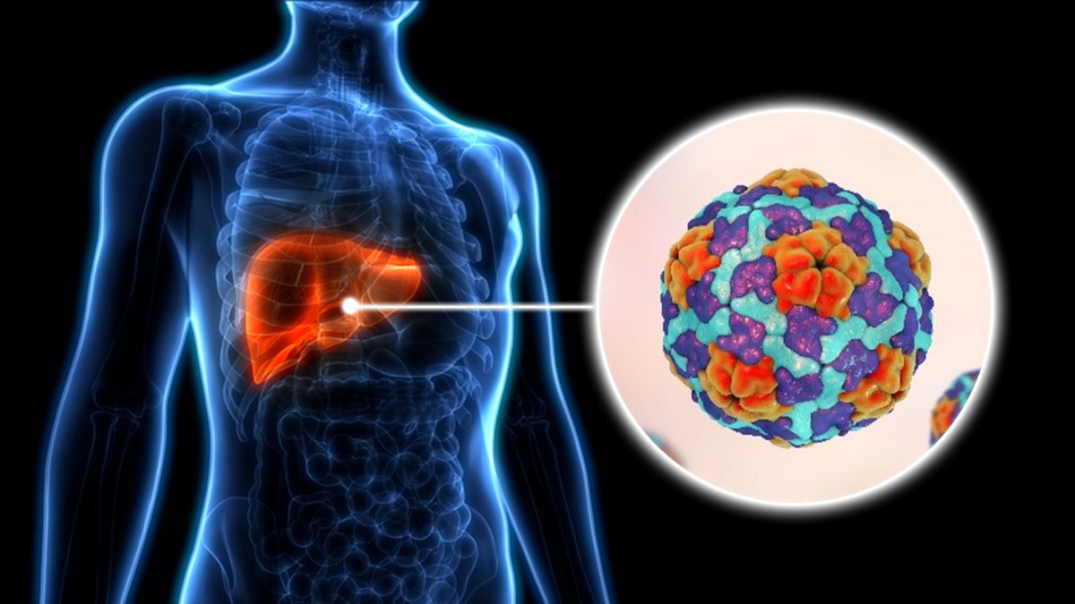 Hepatitis Treatment